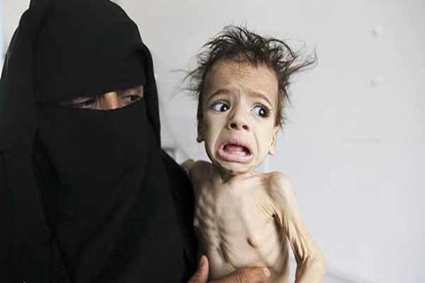 نقش آمریکا در فاجعه انسانی یمن و اقدامات تطهیری دولت بایدن